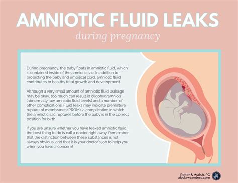 how do you know your leaking amniotic fluid|3 Ways to Identify an Amniotic Fluid Leak